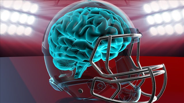 Report: NFL sought to improperly influence study on brain injuries