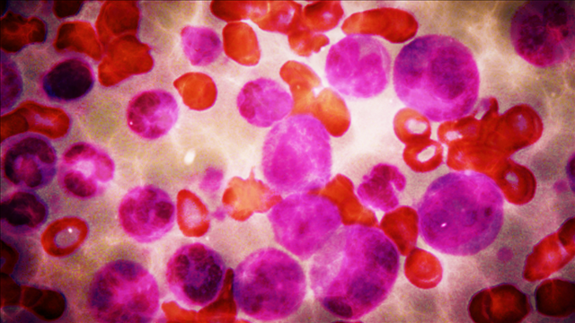 Biden to speak about ambitious push to find cancer cure