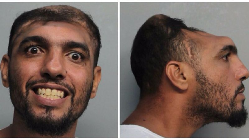 Man with severely deformed skull faces arson, murder charges