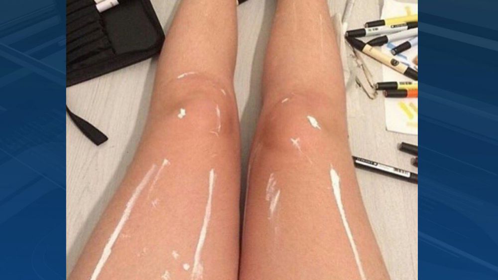 Twitter debates rages over photo of shiny or painted legs