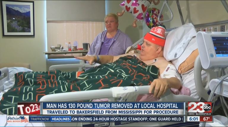 Mississippi man has 130-pound tumor removed in Bakersfield