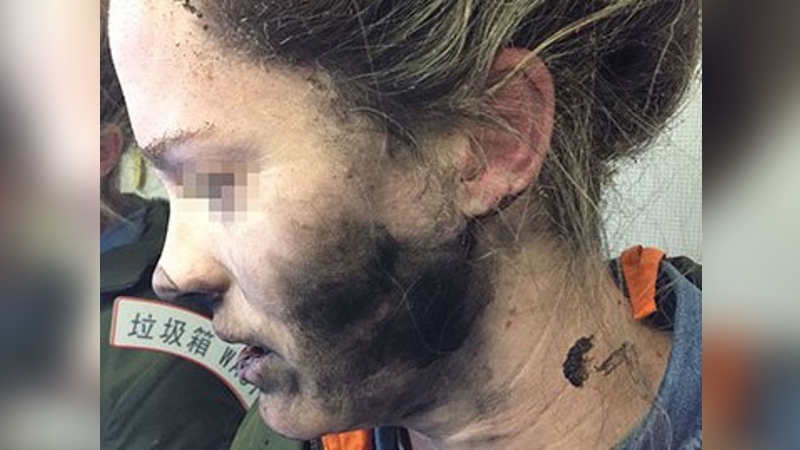 Woman's headphones catch fire midflight to Australia