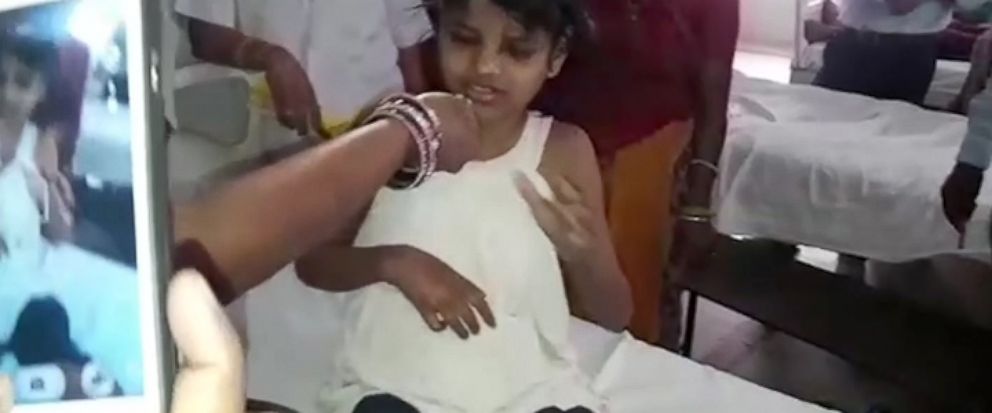 Girl found living with monkeys in forest in India