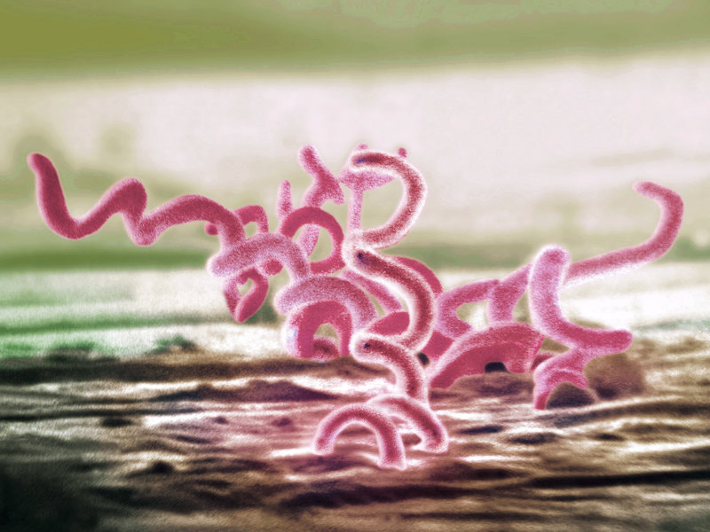 Syphilis far more common in gay man in US South