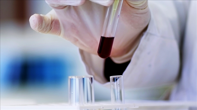 FDA, CDC warn some lead poisoning tests may not be accurate