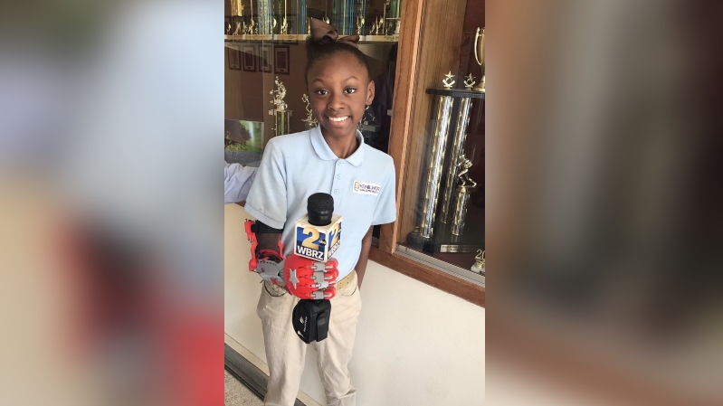 Students make prosthetic hand for classmate using 3D printer